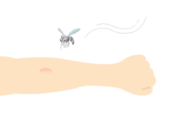 虫刺されの無料イラスト